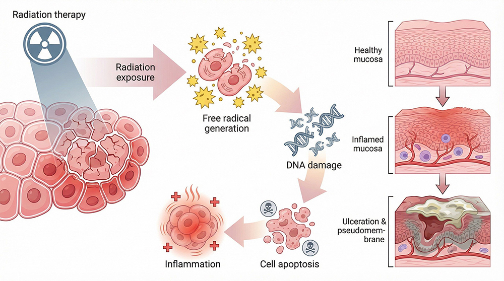 為什麼放射治療會造成口腔黏膜炎？
